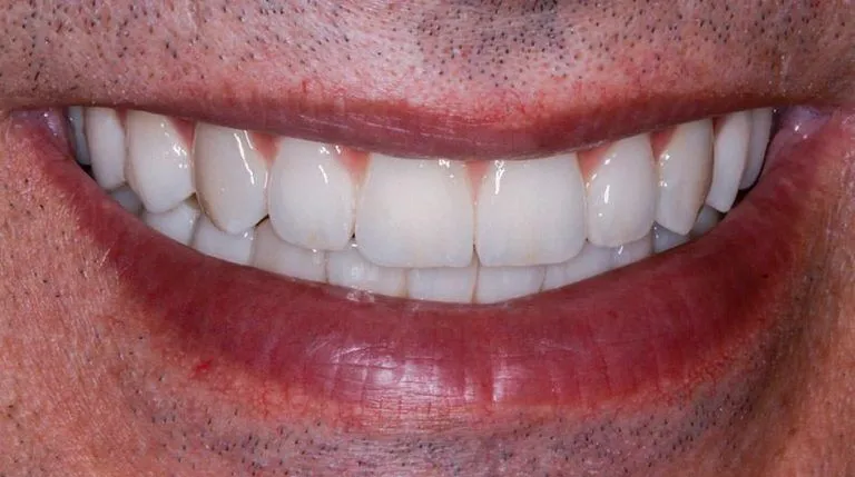 3d-implant-case-02a-768x429