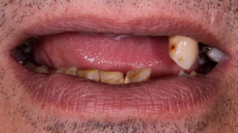 3d-implant-case-02b-768x429